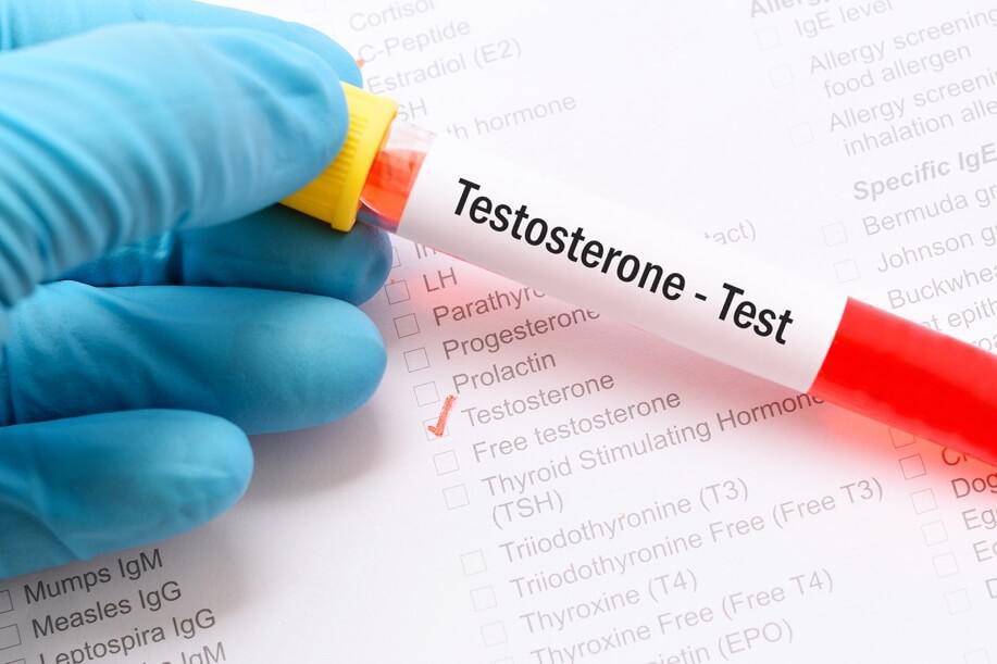 testosterone 